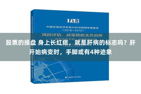 股票的操盘 身上长红痣，就是肝病的标志吗？肝开始病变时，手脚或有4种迹象